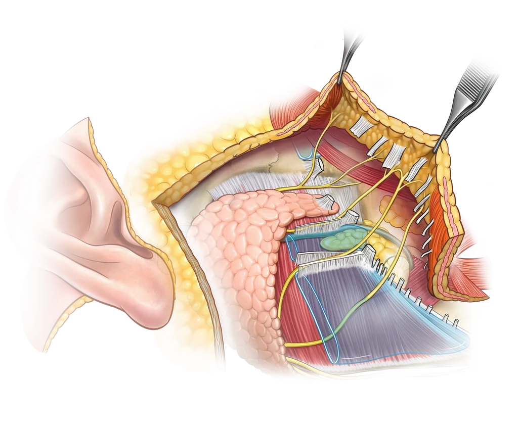 Anatomical illustration of facial tissue layers and nerves beside the ear.